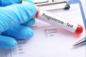 Progesterone Test Explained
